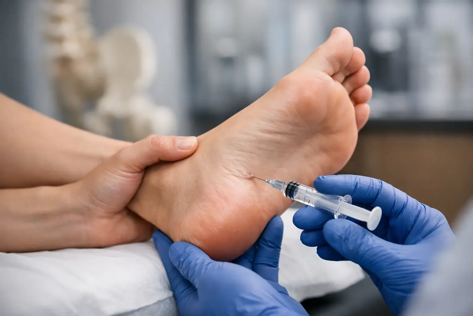 Injection Plantar Fasciitis Treatment Guide